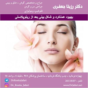 بهبود عملکرد و شکل بینی بعد از رینوپلاستی