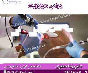 همه چیز درباره جراحی سینوزیت + مراحل و مراقبتها