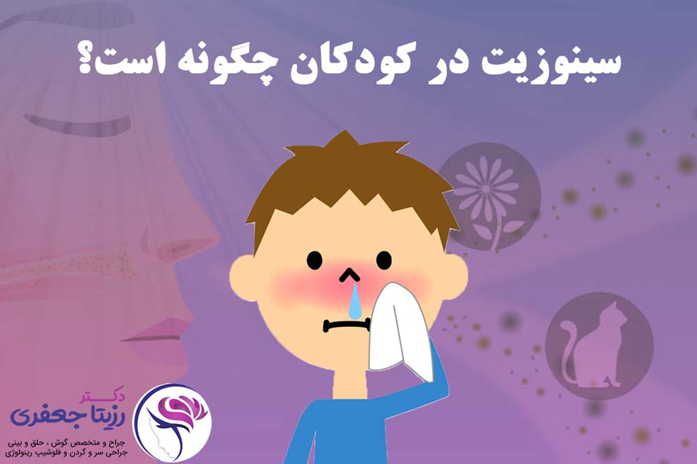 سینوزیت در کودک