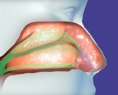 انسداد-بینی-1