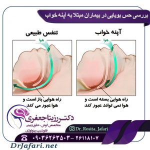 بررسی حس بویایی در بیماران مبتلا به آپنه خواب