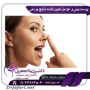 پوست بینی عوامل تعیین کننده نتایج جراحی