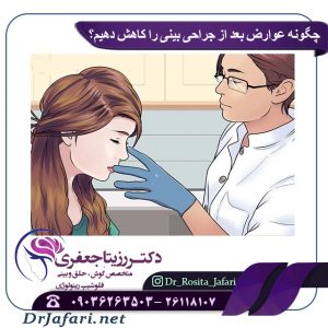 چگونه عوارض بعد از جراحی بینی را کاهش دهیم؟