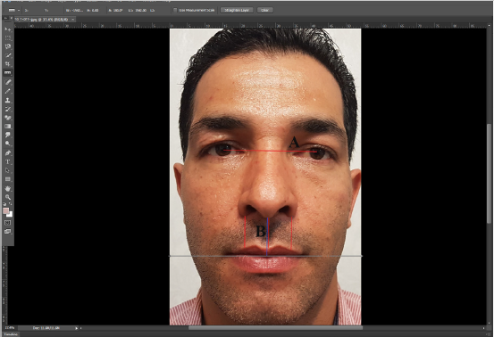 فاصله بین دو مردمک چشم