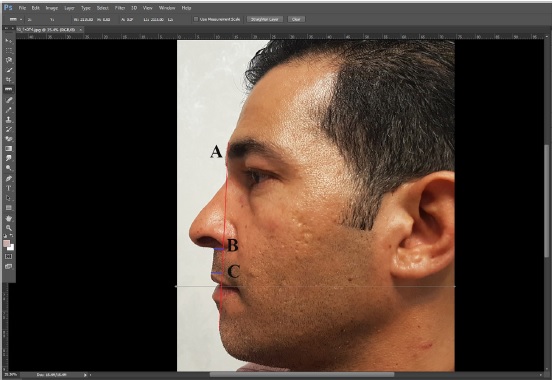 فاصله-مردمک-دو-چشم-از-نمای-نیم-رخ