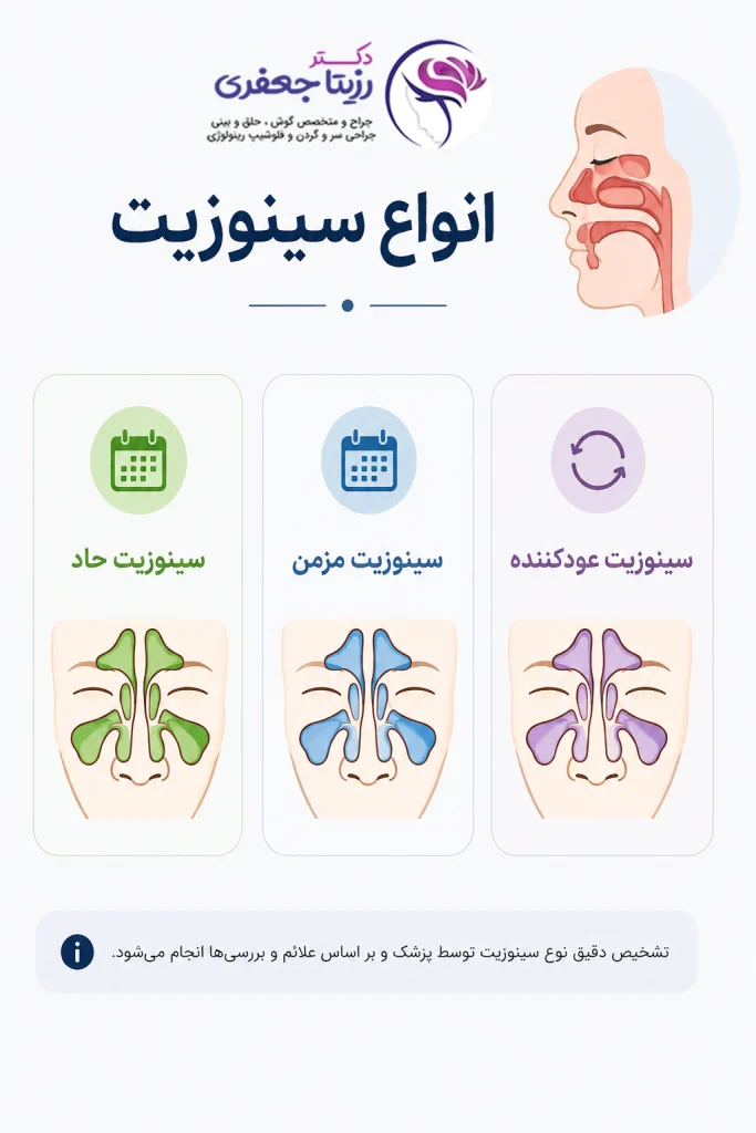انواع سینوزیت