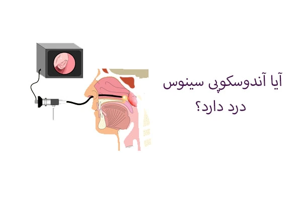 آیا آندوسکوپی سینوس درد دارد؟