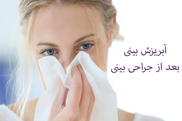 آبریزش بینی بعد از جراحی بینی