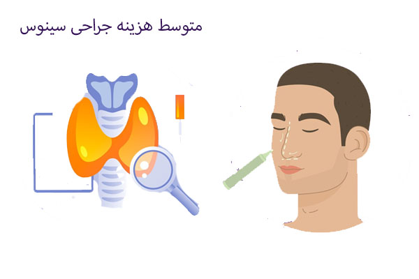 متوسط هزینه جراحی سینوس
