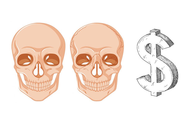 هزینه جراحی قاعده جمجمه
