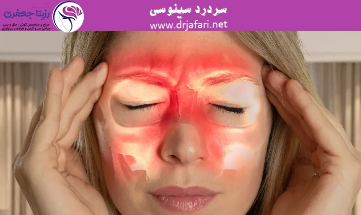 سردرد سینوسی