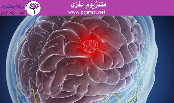 مننژیوم مغزی