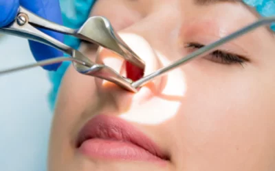 جراحی بینی برای مبتلایان به سینوزیت؛ ترکیب زیبایی و سلامت + فیلم
