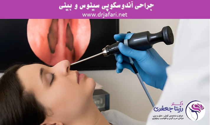 جراحی آندوسکوپی سینوس و بینی