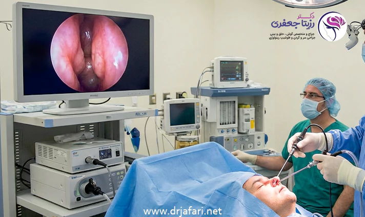 زمان انجام جراحی عود پولیپ بینی